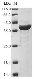 (Tris-Glycine gel) Discontinuous SDS-PAGE (reduced) with 5% enrichment gel and 15% separation gel.