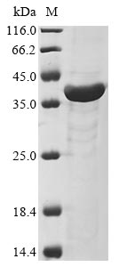 (Tris-Glycine gel) Discontinuous SDS-PAGE (reduced) with 5% enrichment gel and 15% separation gel.