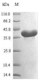(Tris-Glycine gel) Discontinuous SDS-PAGE (reduced) with 5% enrichment gel and 15% separation gel.