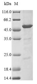 (Tris-Glycine gel) Discontinuous SDS-PAGE (reduced) with 5% enrichment gel and 15% separation gel.
