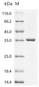(Tris-Glycine gel) Discontinuous SDS-PAGE (reduced) with 5% enrichment gel and 15% separation gel.