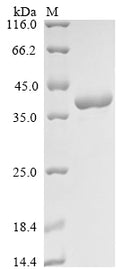 (Tris-Glycine gel) Discontinuous SDS-PAGE (reduced) with 5% enrichment gel and 15% separation gel.