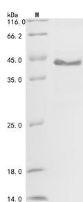 (Tris-Glycine gel) Discontinuous SDS-PAGE (reduced) with 5% enrichment gel and 15% separation gel.