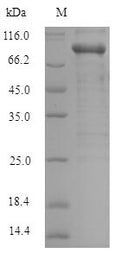 Recombinant Human Serine/threonine-protein kinase PAK 1 (PAK1) – Figure 1 of 1