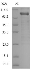 Recombinant Human Serine/threonine-protein kinase PAK 1 (PAK1) – Figure 1 of 1