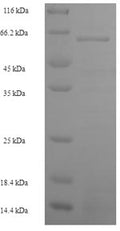 Recombinant Human S-phase kinase-associated protein 2 (SKP2) – Figure 1 of 1