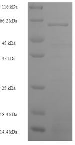 Recombinant Human S-phase kinase-associated protein 2 (SKP2) – Figure 1 of 1
