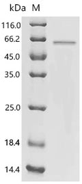 Recombinant Human Krueppel-like factor 5 (KLF5) – Figure 1 of 1