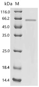 Recombinant Human Krueppel-like factor 5 (KLF5) – Figure 1 of 1