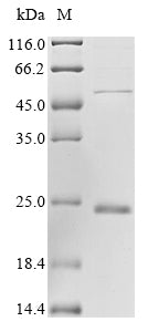(Tris-Glycine gel) Discontinuous SDS-PAGE (reduced) with 5% enrichment gel and 15% separation gel.