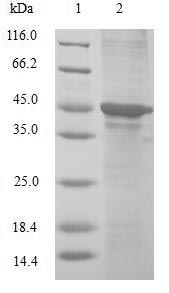 (Tris-Glycine gel) Discontinuous SDS-PAGE (reduced) with 5% enrichment gel and 15% separation gel.