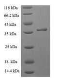Recombinant Human Peptidyl-tRNA hydrolase ICT1, mitochondrial (ICT1) – Figure 1 of 1