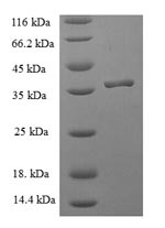 Recombinant Human Peptidyl-tRNA hydrolase ICT1, mitochondrial (ICT1) – Figure 1 of 1
