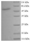 Recombinant Human UDP-glucose 4-epimerase (GALE) – Figure 1 of 1