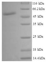 Recombinant Human UDP-glucose 4-epimerase (GALE) – Figure 1 of 1