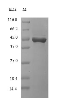 (Tris-Glycine gel) Discontinuous SDS-PAGE (reduced) with 5% enrichment gel and 15% separation gel.