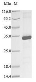 (Tris-Glycine gel) Discontinuous SDS-PAGE (reduced) with 5% enrichment gel and 15% separation gel.