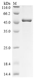 (Tris-Glycine gel) Discontinuous SDS-PAGE (reduced) with 5% enrichment gel and 15% separation gel.