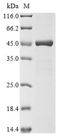(Tris-Glycine gel) Discontinuous SDS-PAGE (reduced) with 5% enrichment gel and 15% separation gel.