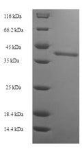 Recombinant Human Protein SSX2 (SSX2) – Figure 1 of 1