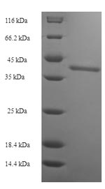 Recombinant Human Protein SSX2 (SSX2) – Figure 1 of 1