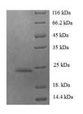 Recombinant Human C-C motif chemokine 14 (CCL14) – Figure 1 of 1