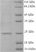 Recombinant Human Guanylate cyclase activator 2B (GUCA2B) – Figure 1 of 1