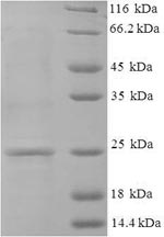 Recombinant Human Guanylate cyclase activator 2B (GUCA2B) – Figure 1 of 1