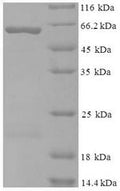 Recombinant Human Kynurenine--oxoglutarate transaminase 1 (KYAT1) – Figure 1 of 1
