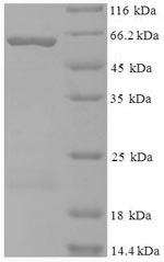 Recombinant Human Kynurenine--oxoglutarate transaminase 1 (KYAT1) – Figure 1 of 1
