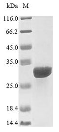 (Tris-Glycine gel) Discontinuous SDS-PAGE (reduced) with 5% enrichment gel and 15% separation gel.