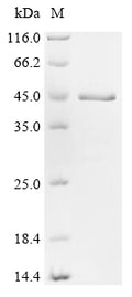(Tris-Glycine gel) Discontinuous SDS-PAGE (reduced) with 5% enrichment gel and 15% separation gel.