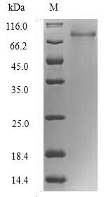 Recombinant Human RNA-binding motif protein, Y chromosome, family 1 member F/J (RBMY1F) – Figure 1 of 1