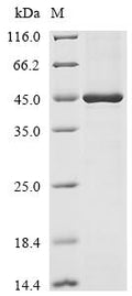 (Tris-Glycine gel) Discontinuous SDS-PAGE (reduced) with 5% enrichment gel and 15% separation gel.