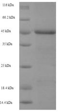 Recombinant Human Baculoviral IAP repeat-containing protein 1 (NAIP), partial – Figure 1 of 1