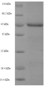 Recombinant Human Baculoviral IAP repeat-containing protein 1 (NAIP), partial – Figure 1 of 1