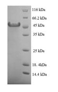 Recombinant Human Hyaluronan-binding protein 2 (HABP2), partial – Figure 1 of 1