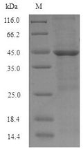 Recombinant Human Hyaluronan-binding protein 2 (HABP2), partial – Figure 1 of 1