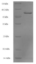 Recombinant Human Septin-2 (SEPTIN2) – Figure 1 of 1