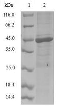 (Tris-Glycine gel) Discontinuous SDS-PAGE (reduced) with 5% enrichment gel and 15% separation gel.