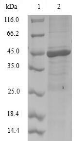 (Tris-Glycine gel) Discontinuous SDS-PAGE (reduced) with 5% enrichment gel and 15% separation gel.