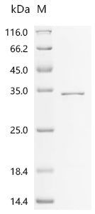 (Tris-Glycine gel) Discontinuous SDS-PAGE (reduced) with 5% enrichment gel and 15% separation gel.
