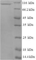 Recombinant Human Nucleolar GTP-binding protein 2 (GNL2) – Figure 1 of 1