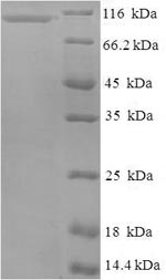 Recombinant Human Nucleolar GTP-binding protein 2 (GNL2) – Figure 1 of 1