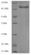 Recombinant Human Electron transfer flavoprotein-ubiquinone oxidoreductase, mitochondrial (ETFDH) – Figure 1 of 1