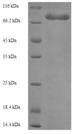 Recombinant Human Electron transfer flavoprotein-ubiquinone oxidoreductase, mitochondrial (ETFDH) – Figure 1 of 1