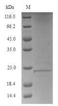 Recombinant Human Lymphocyte antigen 6E (LY6E) – Figure 1 of 1