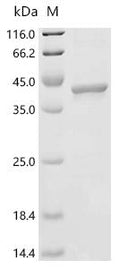 (Tris-Glycine gel) Discontinuous SDS-PAGE (reduced) with 5% enrichment gel and 15% separation gel.