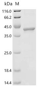 (Tris-Glycine gel) Discontinuous SDS-PAGE (reduced) with 5% enrichment gel and 15% separation gel.