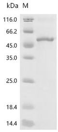 Recombinant Human Dual specificity protein phosphatase 4 (DUSP4) – Figure 1 of 1
